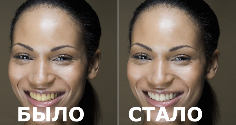 Способы отбеливания зубов в Фотошопе Способы отбеливания зубов в Фотошопе